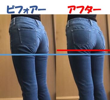 サンテラボ骨盤ガードル